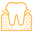 Cosmetic Periodontal Surgery
